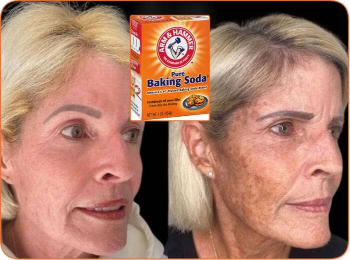 How to remove dark spots on face with baking soda