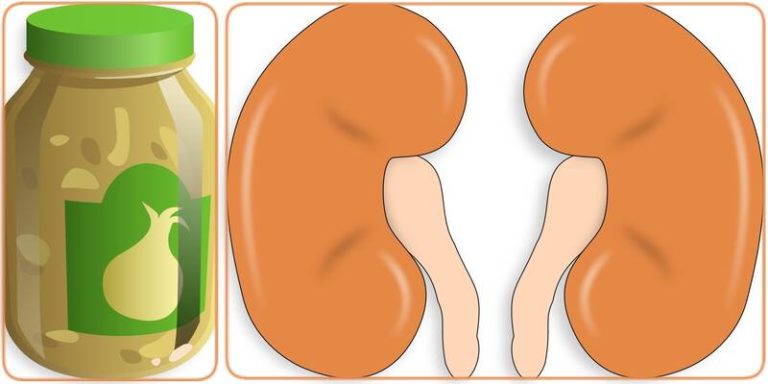 how-to-use-garlic-to-treat-kidney-failure-stones-and-creatinine