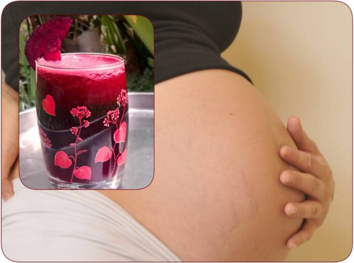 best time to eat beetroot during pregnancy benefits and side effects