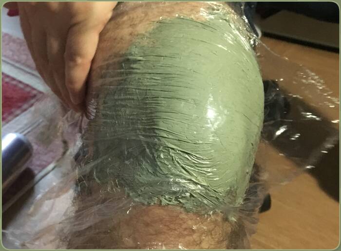 green clay poultice with cling film for inlammation
