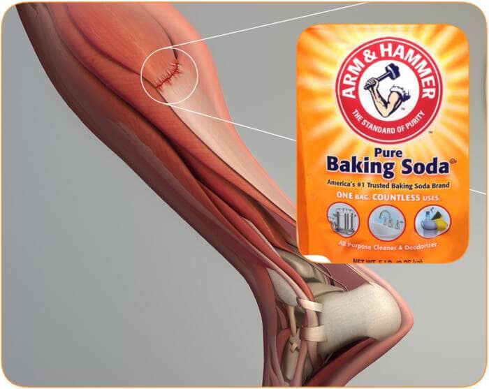 Baking soda for muscles cramps
