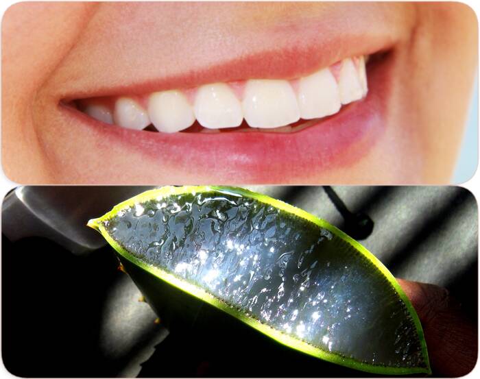 Aloe vera gel for gums and teeth