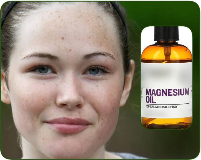 Can you use magnesium oil on face wrinkles