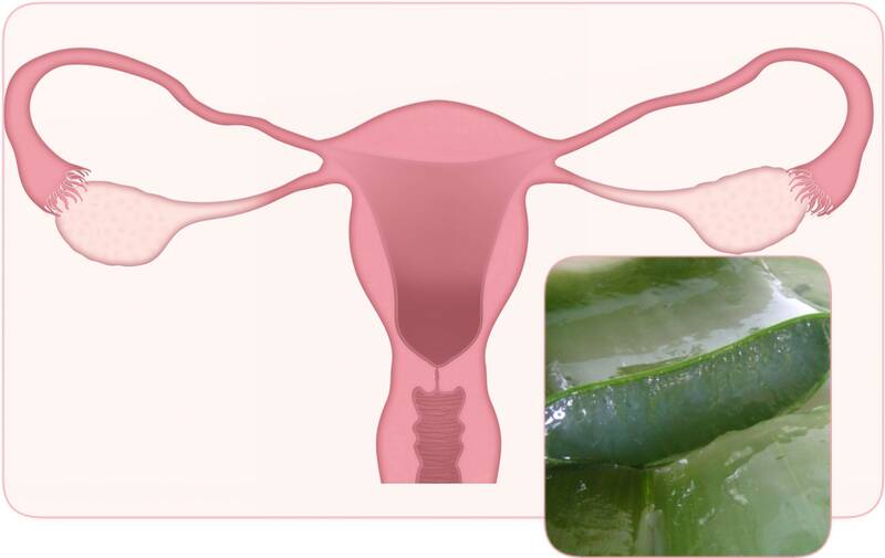 Aloe vera to treat uterine fibroids