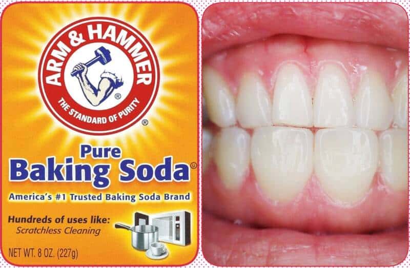 How To Remove Tartar Quickly With Baking Soda